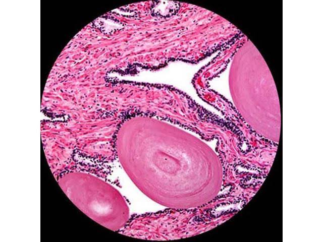 40X-1600X LED Trinocular Compound Microscope P8399